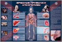 Электрифицированный стенд "Вредные привычки: алкоголизм" - «globural.ru» - Киров